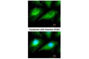 ICC/IF Image Immunofluorescence analysis of methanol-fixed HeLa, using OTUB1, antibody at 1:50 dilution.