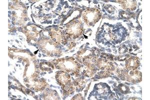 RGS20 antibody was used for immunohistochemistry at a concentration of 4-8 ug/ml to stain Epithelial cells of renal tubule (arrows) in Human Kidney.