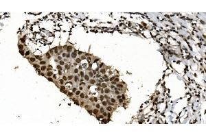 IHC analysis of HNRNPH3 using anti-HNRNPH3 antibody (ABIN7601121).