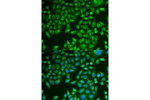 Immunofluorescence analysis of U2OS cell using PNLIP antibody. (PNLIP anticorps)