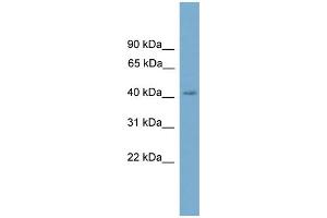 WB Suggested Anti-CXorf9 Antibody Titration: 0. (SASH3 anticorps  (C-Term))