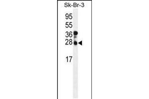 Western blot analysis of CHMP4B Antibody in SK-BR-3 cell line lysates (35ug/lane)