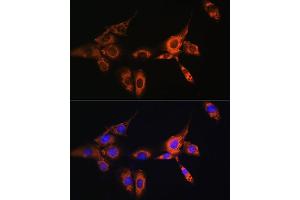 Immunohistochemistry of paraffin-embedded human colon using  Rabbit pAb (ABIN3021619, ABIN3021620, ABIN3021621 and ABIN6215402) at dilution of 1:100 (40x lens).