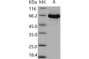 Western Blotting (WB) image for Mitogen-Activated Protein Kinase Kinase 1 (MAP2K1) protein (GST tag,His tag) (ABIN7320325) (MEK1 Protein (GST tag,His tag))