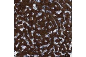 Immunohistochemical staining of human liver with CYP2C19 polyclonal antibody  shows strong cytoplasmic positivity in hepatocytes. (CYP2C9 anticorps)