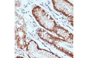 Immunohistochemistry of paraffin-embedded human stomach using CXCL12 antibody (ABIN6130152, ABIN6139271, ABIN6139272 and ABIN6217180) at dilution of 1:100 (40x lens). (CXCL12 anticorps  (AA 22-89))