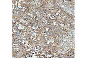 IHC analysis of ICAM1 using anti-ICAM1 antibody (ABIN5692991). (ICAM1 anticorps  (AA 28-268))