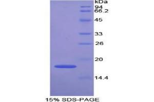 SDS-PAGE analysis of Mouse GPX4 Protein. (GPX4 Protéine)