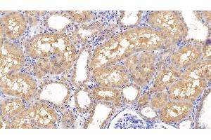 Detection of FZD4 in Human Kidney Tissue using Polyclonal Antibody to Frizzled Homolog 4 (FZD4) (FZD4 anticorps  (AA 37-222))