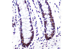 Immunohistochemistry of paraffin-embedded human colon using KHDRBS1/KHDRBS1/Sam68 Rabbit mAb (ABIN1680037, ABIN3018237, ABIN3018238 and ABIN7101585) at dilution of 1:100 (40x lens).