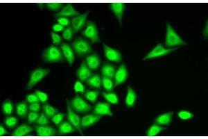 Immunofluorescence analysis of U2OS cells using RNF40 Polyclonal Antibody (RNF40 anticorps)