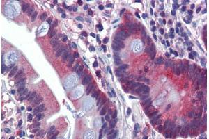 Human Small Intestine (formalin-fixed, paraffin-embedded) stained with ATP6V0A2 antibody ABIN462234 followed by biotinylated goat anti-rabbit IgG secondary antibody ABIN481713, alkaline phosphatase-streptavidin and chromogen.