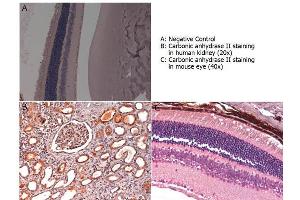 Immunohistochemistry with anti-carbonic anhydrase II antibody showing carbonic anhydrase II staining in nucleus and cytoplasm of proximal and distal tubules, bowman’s capsule and glomerular podocytes of human kidney (B) and in basal cells of retina of a mouse eye (C).
