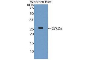 Western Blotting (WB) image for anti-Leukocyte Immunoglobulin-Like Receptor B3 (LILRB3) (AA 410-631) antibody (ABIN1859665) (LILRB3 anticorps  (AA 410-631))