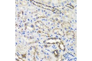 Immunohistochemistry of paraffin-embedded rat kidney using HSD11B2 antibody (ABIN5995471) at dilution of 1/100 (40x lens). (HSD11B2 anticorps)
