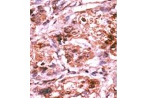 Image no. 2 for anti-Cell Division Cycle 25 Homolog A (S. Pombe) (CDC25A) (pSer293) antibody (ABIN358096) (CDC25A anticorps  (pSer293))