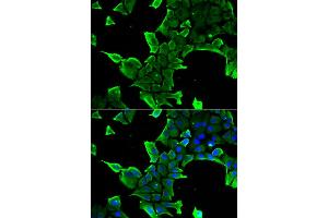 Immunofluorescence analysis of A549 cells using NCS1 antibody. (NCS1 anticorps)