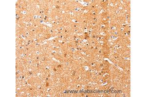 Immunohistochemistry of Human brain using EFNA1 Polyclonal Antibody at dilution of 1:51 (Ephrin A1 anticorps)