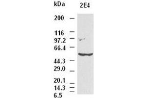 CK8 antibody (2E4) at 1:1000 dilution + Hela cell lysate (KRT8 anticorps  (AA 91-381))