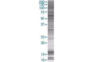 SARS 293T Cell Transient Overexpression Lysate(Denatured)