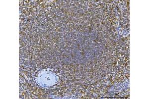 IHC analysis of IRF7 using anti-IRF7 antibody (ABIN7601022). (IRF7 anticorps  (AA 27-503))