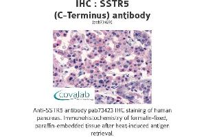 Image no. 1 for anti-Somatostatin Receptor 5 (SSTR5) (C-Term) antibody (ABIN1739676) (SSTR5 anticorps  (C-Term))