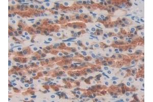 Detection of OIT3 in Rat Stomach Tissue using Polyclonal Antibody to Oncoprotein Induced Transcript 3 (OIT3)