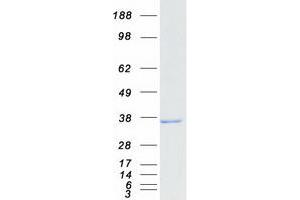 Validation with Western Blot