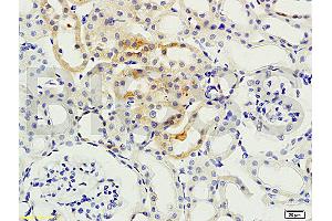 Formalin-fixed and paraffin embedded: rat kidney tissue labeled with Anti-PKCB Polyclonal Antibody, Unconjugated (ABIN727010) at 1:200, followed by conjugation to the secondary antibody and DAB staining (PKC beta anticorps  (AA 601-673))
