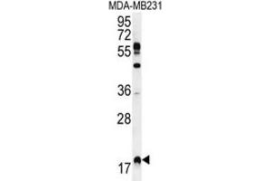 Western Blotting (WB) image for anti-Ras Homolog Enriched in Brain (RHEB) antibody (ABIN2996362)