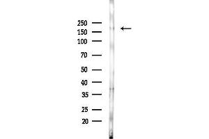 anti-Sperm Specific Antigen 2 (SSFA2) (C-Term) antibody