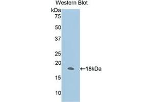 Detection of Recombinant ANXA2, Human using Polyclonal Antibody to Annexin A2 (ANXA2)