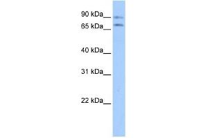 Junctophilin 2 antibody used at 1 ug/ml to detect target protein. (Junctophilin 2 anticorps  (Middle Region))