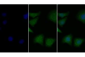Detection of BDNF in Human Hela cell using Polyclonal Antibody to Brain Derived Neurotrophic Factor (BDNF)