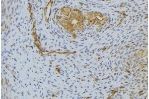 ABIN6276594 at 1/100 staining Human uterus tissue by IHC-P. (HGF anticorps  (Internal Region))