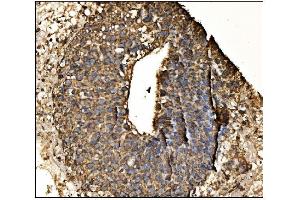 IHC analysis of Arginine Decarboxylase/AZIN2 using anti-Arginine Decarboxylase/AZIN2 antibody (ABIN7599403). (ADC anticorps  (AA 1-448))