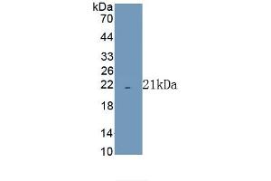 Detection of Recombinant COX4I1, Human using Polyclonal Antibody to Cytochrome C Oxidase Subunit IV Isoform 1 (COX4I1)