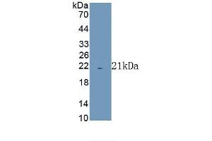 Detection of Recombinant COX4I1, Human using Polyclonal Antibody to Cytochrome C Oxidase Subunit IV Isoform 1 (COX4I1) (COX IV anticorps  (AA 1-169))