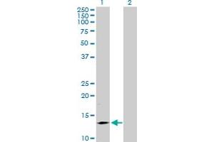 Western Blot analysis of SMA4 expression in transfected 293T cell line by SMA4 MaxPab polyclonal antibody. (SMN1 anticorps  (AA 1-140))