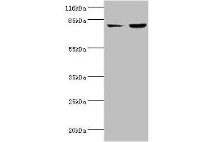 Western blot All lanes: ACSL4 antibody at 2 μg/mL Lane 1: HepG2 whole cell lysate Lane 2: Hela whole cell lysate Secondary Goat polyclonal to rabbit IgG at 1/10000 dilution Predicted band size: 80, 75 kDa Observed band size: 80 kDa (ACSL4 anticorps  (AA 457-670))