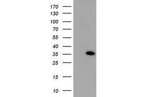 Image no. 1 for anti-Sulfotransferase Family, Cytosolic, 1A, Phenol-Preferring, Member 1 (SULT1A1) antibody (ABIN1501225) (SULT1A1 anticorps)