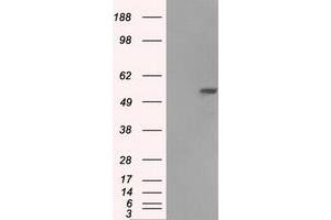 Image no. 7 for anti-Fumarate Hydratase (FH) antibody (ABIN1498267)