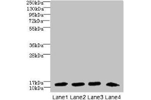 Western blot All lanes: DNAL4 antibody at 1. (DNAL4 anticorps  (AA 1-105))