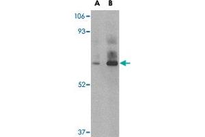 Western blot analysis of DHX58 in rat kidney tissue lysate with DHX58 polyclonal antibody  at (A) 1 and (B) 2 ug/mL . (DHX58 anticorps  (C-Term))