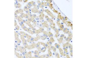 Immunohistochemistry of paraffin-embedded human liver injury using CETN3 antibody at dilution of 1:100 (x40 lens). (CETN3 anticorps)