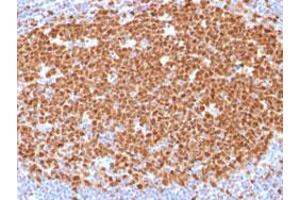 Immunohistochemical staining (Formalin-fixed paraffin-embedded sections) of human tonsil with MCM7 monoclonal antibody, clone MCM7/1468 . (MCM7 anticorps  (AA 195-319))