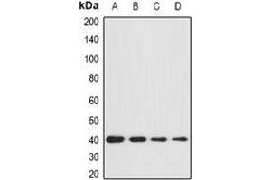 Western blot analysis of GNA11 expression in BT474 (A), SKOV3 (B), mouse brain (C), mouse kidney (D) whole cell lysates.