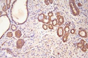 IHC analysis of Hsp20 using anti-Hsp20 antibody (ABIN5518920). (HSPB6 anticorps  (AA 73-123))