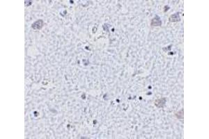 Immunohistochemistry of BRSK1 in human brain tissue with BRSK1 antibody at 5 μg/ml.