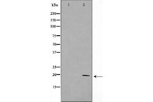 Western blot analysis on HepG2 cell lysate using KAD6 Antibody，The lane on the left is treated with the antigen-specific peptide.